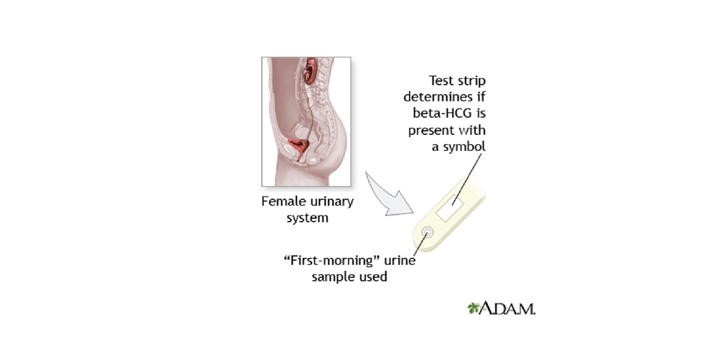 Human Chorionic Gonadotropin Hcg Pregnancy Test Rnpedia - 