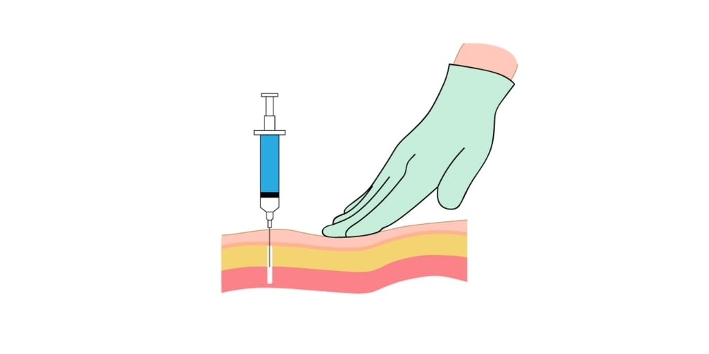 Administering Intramuscular Injections - RNpedia